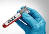 Suspeita de ebola é descartada em pacientes no Rio de Janeiro e em São Paulo