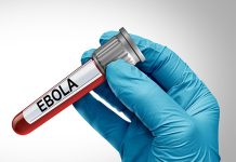 Suspeita de ebola é descartada em pacientes no Rio de Janeiro e em São Paulo